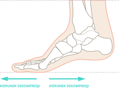 Pozycja stopy w aparacie Bunito Duo podczas leczenia haluksów